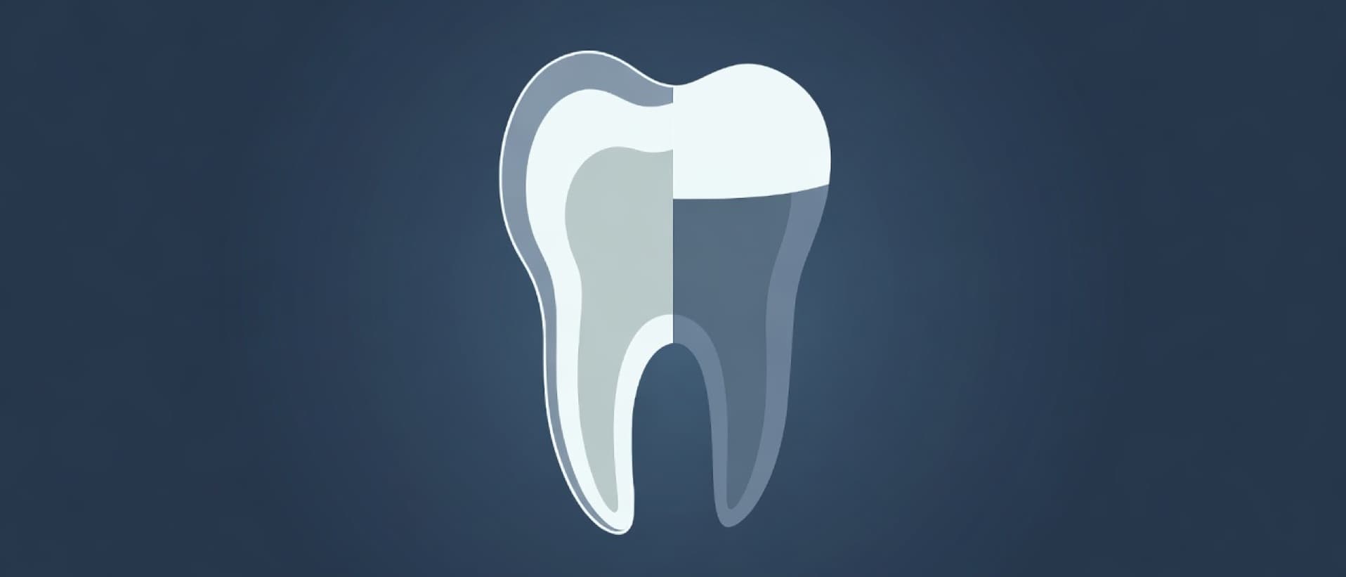 Tooth cross-section with a thin veneer shell on one side and a crown over a ground-down stump, for Turkey teeth